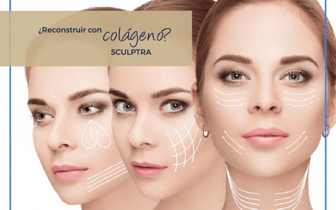 Sculptra