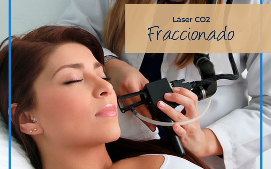 ¿Qué es un láser CO2 fraccionado?