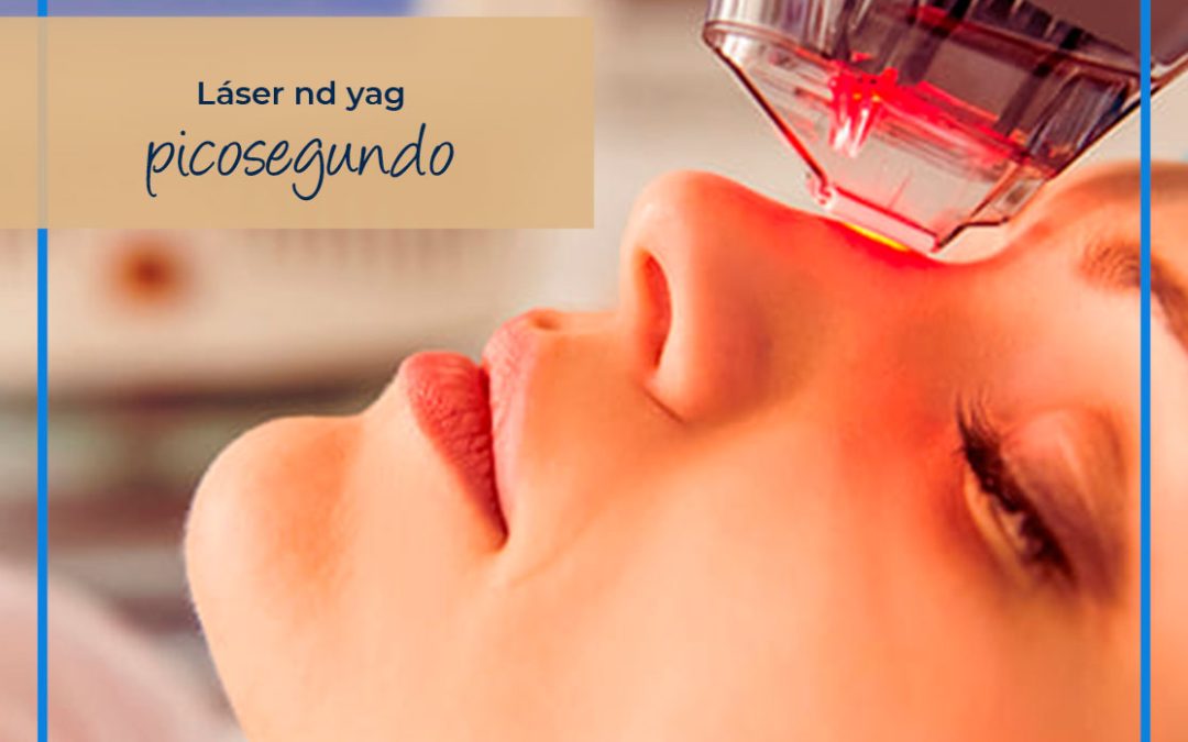 ¿Qué es un Láser ND – Yag Picosegundo?